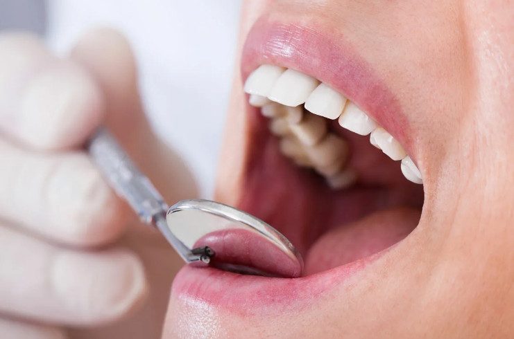 Кариес зубов: профилактика и лечение