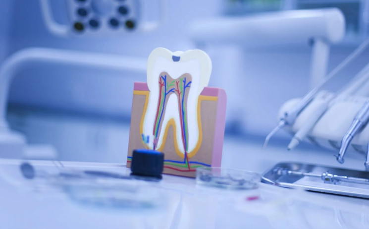 Лечение корневых каналов зуба