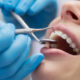 Стоматологические услуги - важный выбор при лечения зубов