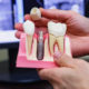 Современная стоматология и имплантация